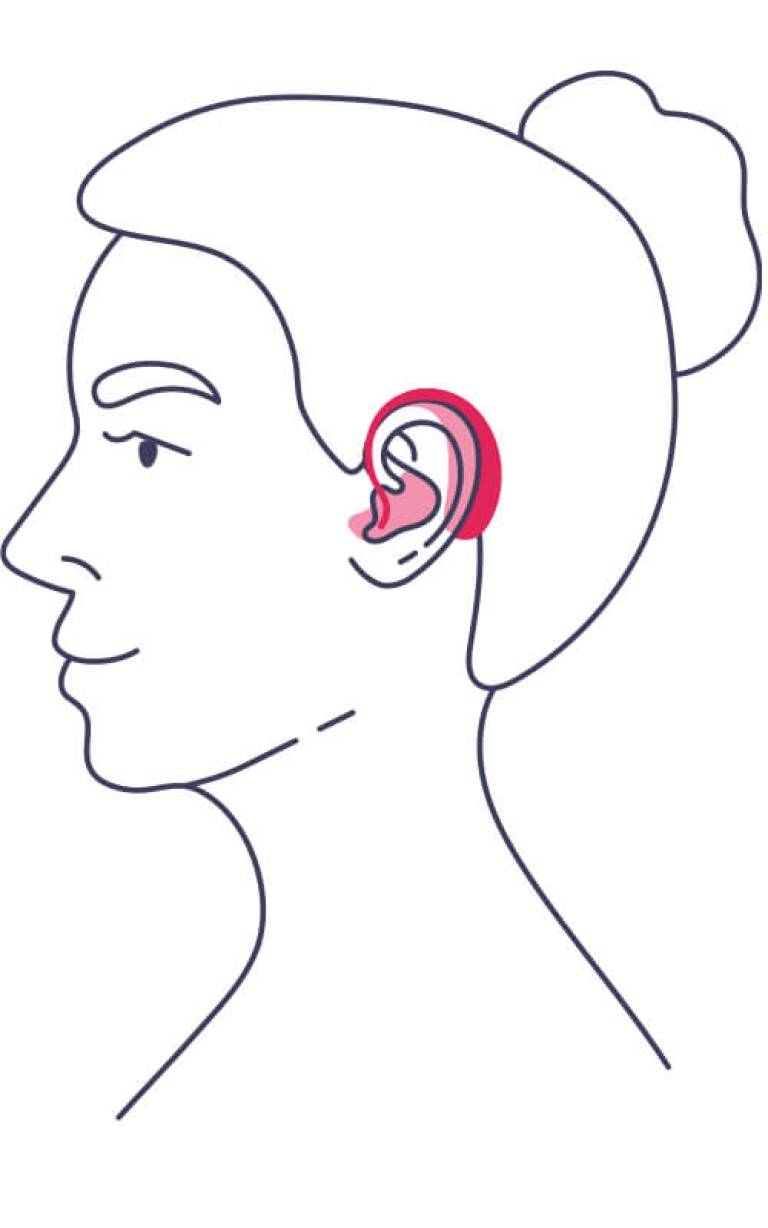 Illustration einer Person mit einem roten Hinter-dem-Ohr-Hörgerät